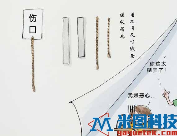 药捻示意图
